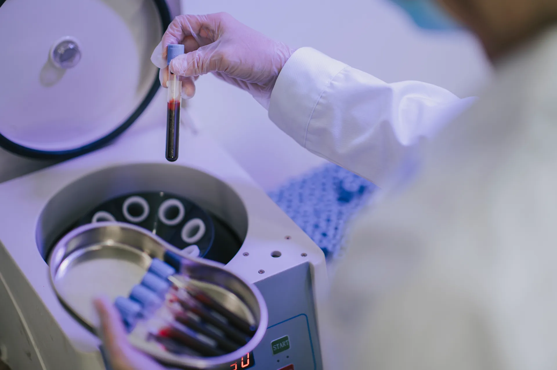 PRP & Stem Cell Therapy