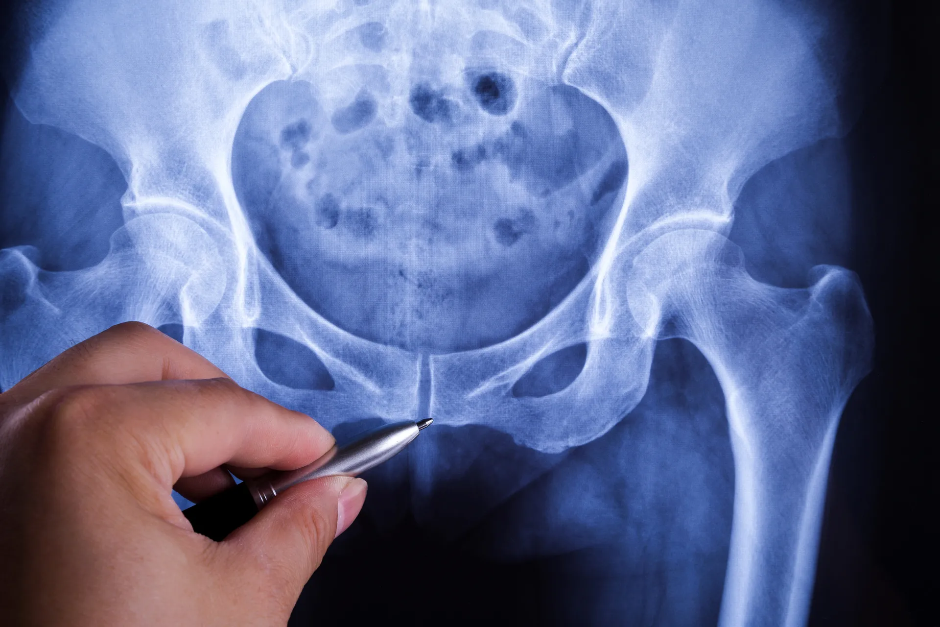 Diagnostic ultrasound at Metro Pain Centers